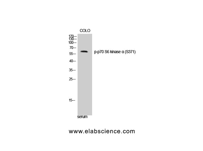 Phospho-p70 S6 kinase alpha (Ser371) Polyclonal Antibody