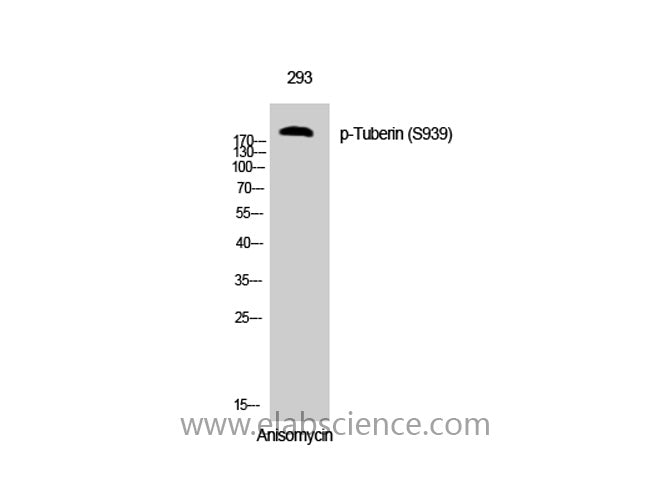 Phospho-Tuberin (Ser939) Polyclonal Antibody