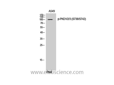 Phospho-PRKD1/2/3 (Ser738/S742) Polyclonal Antibody