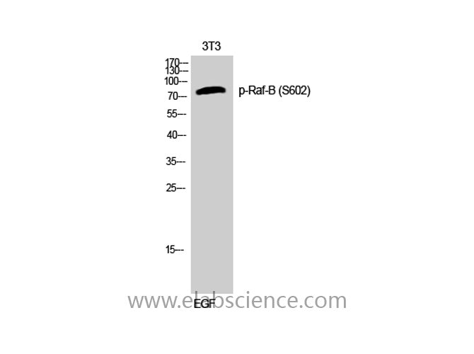 Phospho-BRAF (Ser602) Polyclonal Antibody