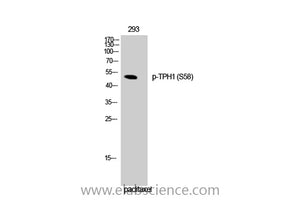 Phospho-TPH1 (Ser58) Polyclonal Antibody