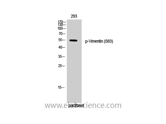 Phospho-Vimentin (Ser83) Polyclonal Antibody