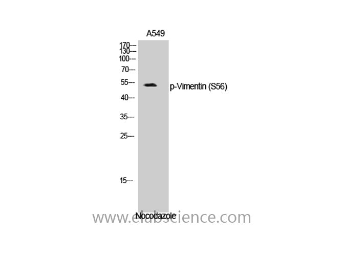 Phospho-Vimentin (Ser56) Polyclonal Antibody