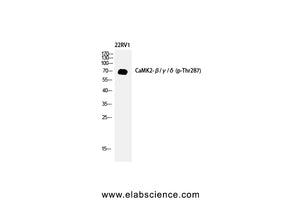 Phospho-CAMK2 beta/gamma/delta (Thr287) Polyclonal Antibody