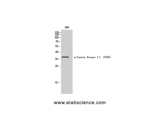 Phospho-CSNK1A1 (Tyr294) Polyclonal Antibody