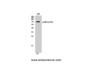 Phospho-RIPK2 (Ser176) Polyclonal Antibody
