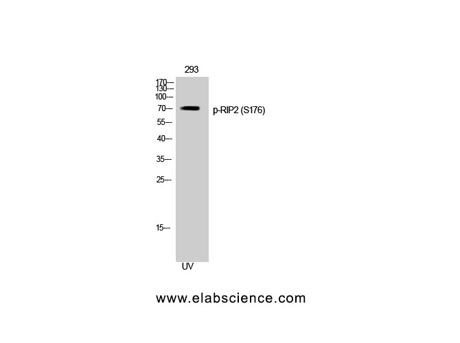 Phospho-RIPK2 (Ser176) Polyclonal Antibody