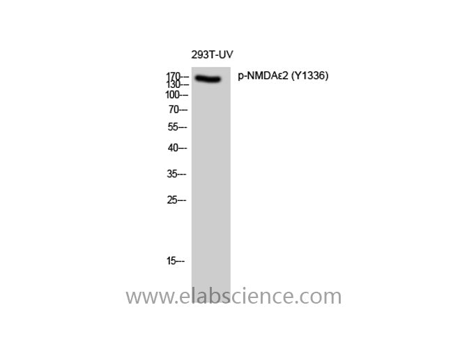 Phospho-GRIN2B (Tyr1336) Polyclonal Antibody