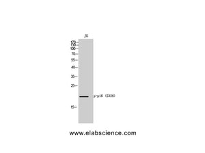 Phospho-p16 (Ser326) Polyclonal Antibody
