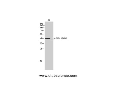 Phospho-TOB1 (Ser164) Polyclonal Antibody