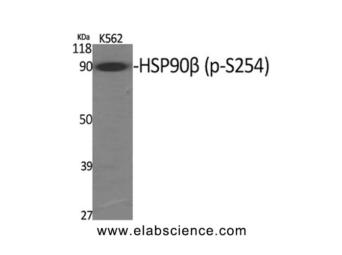 Phospho-HSP90 beta (Ser254) Polyclonal Antibody