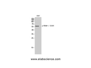 Phospho-CD226 (Ser329) Polyclonal Antibody