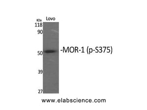 Phospho-OPRM1 (Ser375) Polyclonal Antibody