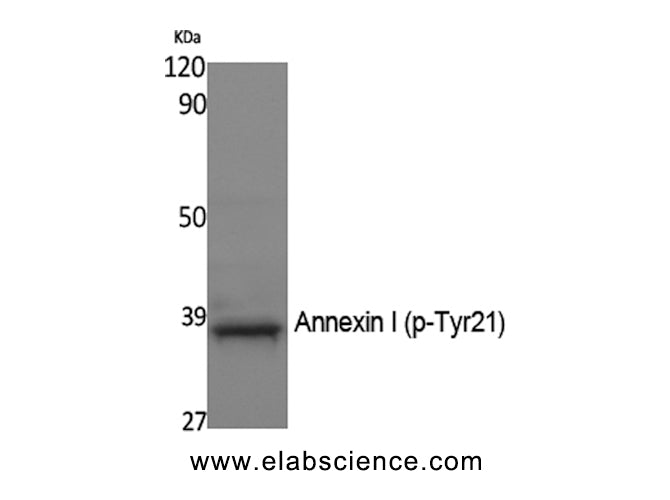 Phospho-ANXA1 (Tyr21) Polyclonal Antibody