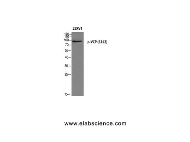 Phospho-VCP (Ser352) Polyclonal Antibody