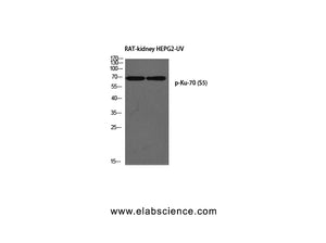 Phospho-XRCC6 (Ser5) Polyclonal Antibody