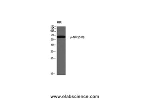 Phospho-NF2 (Ser10) Polyclonal Antibody