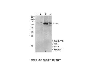 Phospho-MAPKAPK5 (Thr182) Polyclonal Antibody