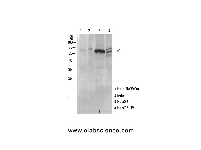 Phospho-MAPKAPK5 (Thr182) Polyclonal Antibody