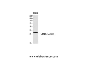 Phospho-PPP2CA (Tyr307) Polyclonal Antibody