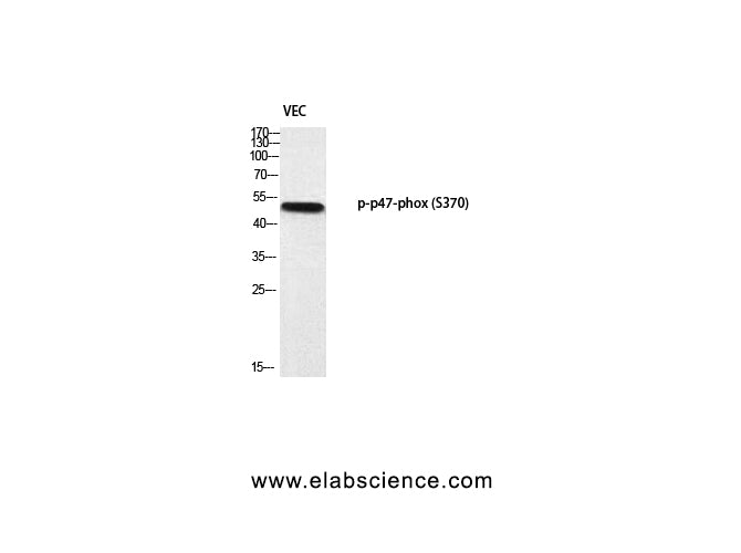 Phospho-p47-phox (Ser370) Polyclonal Antibody