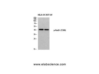 Phospho-RAD51 (Thr309) Polyclonal Antibody