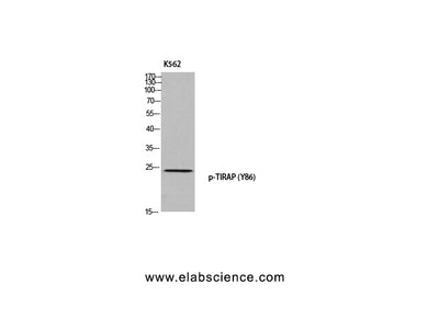 Phospho-TIRAP (Tyr86) Polyclonal Antibody