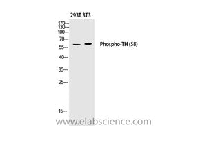Phospho-TH (Ser8) Polyclonal Antibody