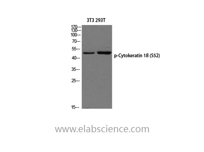 Phospho-CK-18 (Ser52) Polyclonal Antibody