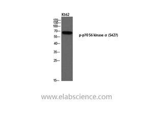 Phospho-p70 S6 kinase alpha (Ser427) Polyclonal Antibody