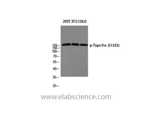 Phospho-TOP2A (Ser1525) Polyclonal Antibody