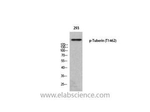 Phospho-Tuberin (Thr1462) Polyclonal Antibody