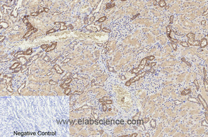 Cleaved-CASP8 (D384) Polyclonal Antibody