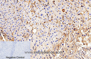 Cleaved-CASP9 p35 (D315) Polyclonal Antibody