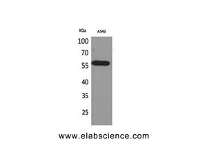 ALDH2 Polyclonal Antibody