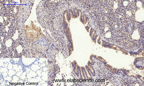 GLUT-4 Polyclonal Antibody