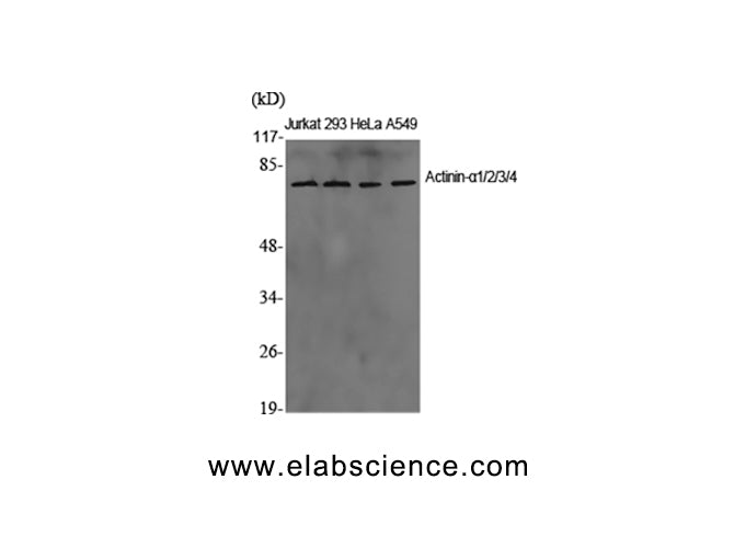 ACTN1/2/3/4 Polyclonal Antibody