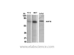 AKAP8 Polyclonal Antibody