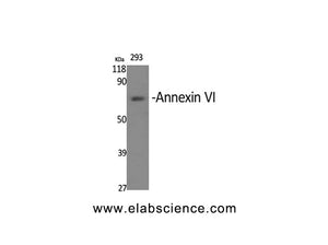 ANXA6 Polyclonal Antibody