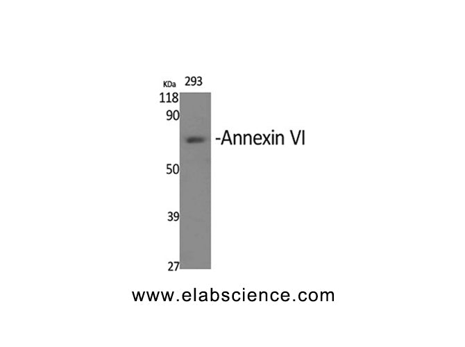 ANXA6 Polyclonal Antibody