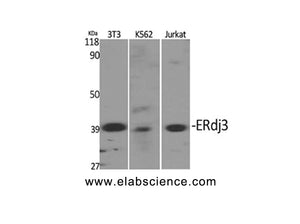 DNAJB11 Polyclonal Antibody