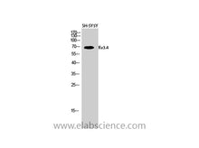KCNC4 Polyclonal Antibody