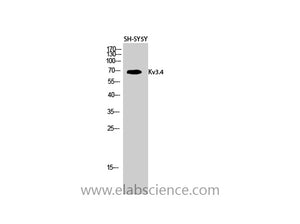 KCNC4 Polyclonal Antibody