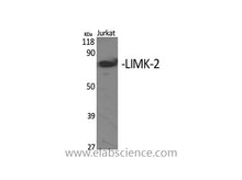 LIMK2 Polyclonal Antibody
