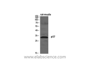 p57kip2 Polyclonal Antibody