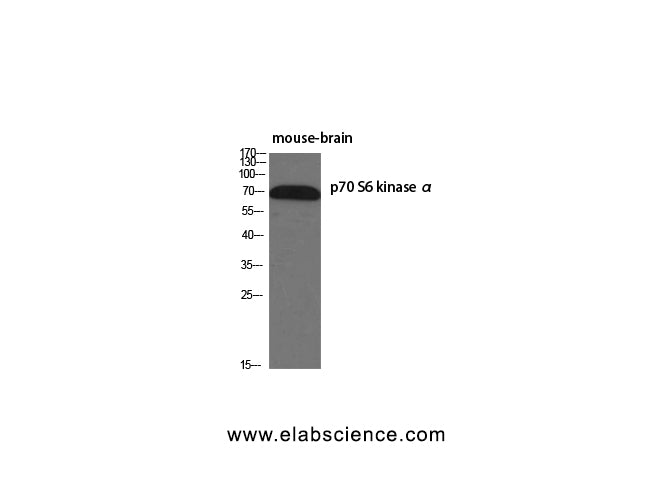 p70 S6 kinase alpha Polyclonal Antibody