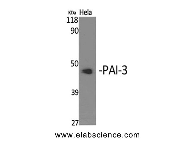 SERPINA5 Polyclonal Antibody