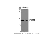 PHKG1 Polyclonal Antibody