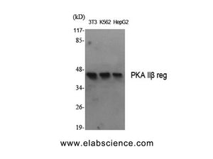 PRKAR2B Polyclonal Antibody