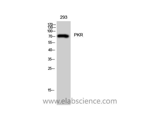 EIF2AK2 Polyclonal Antibody